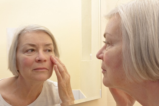 Age Spots Causes and Prevention in Lincoln, CA